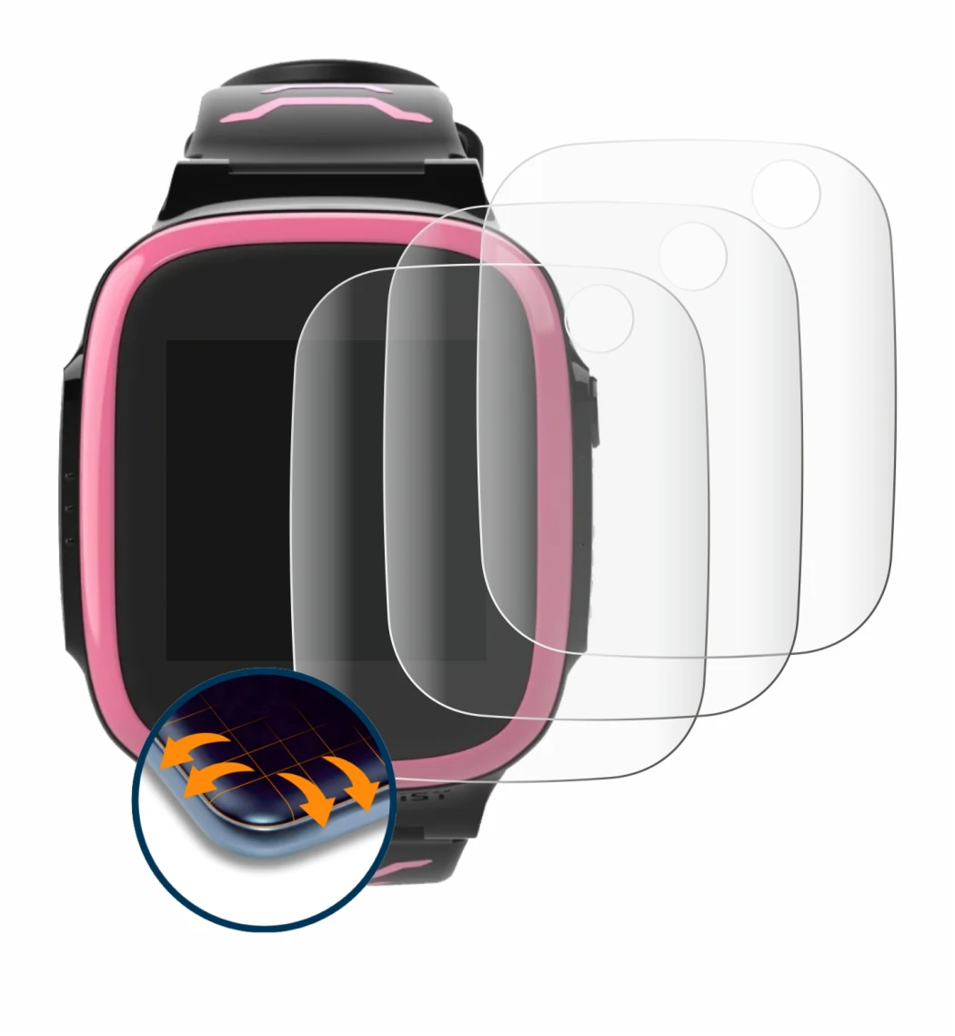 Immagine del dispositivo Xplora X5 Play con un'ampia varietà di protezioni per lo schermo.