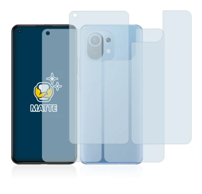 Immagine del dispositivo Xiaomi Mi 11 Lite 5G (Fronte+Retro) con un'ampia varietà di protezioni per lo schermo.