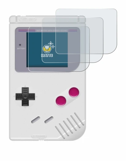 Immagine del dispositivo Nintendo Gameboy (1989) con un'ampia varietà di protezioni per lo schermo.