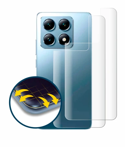 Immagine del dispositivo Xiaomi 14T Pro (Posteriore) con un'ampia varietà di protezioni per lo schermo.